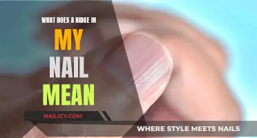 Unraveling the Mystery: What Your Ridge-Shaped Nail Tells About Your Health