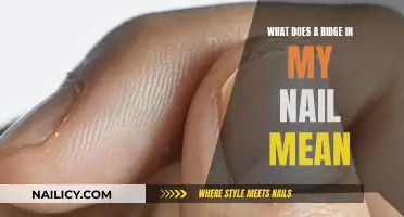 Ridges in Nails: What Do They Mean?