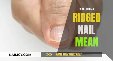 Understanding Ridged Nails: Causes and Treatment Options