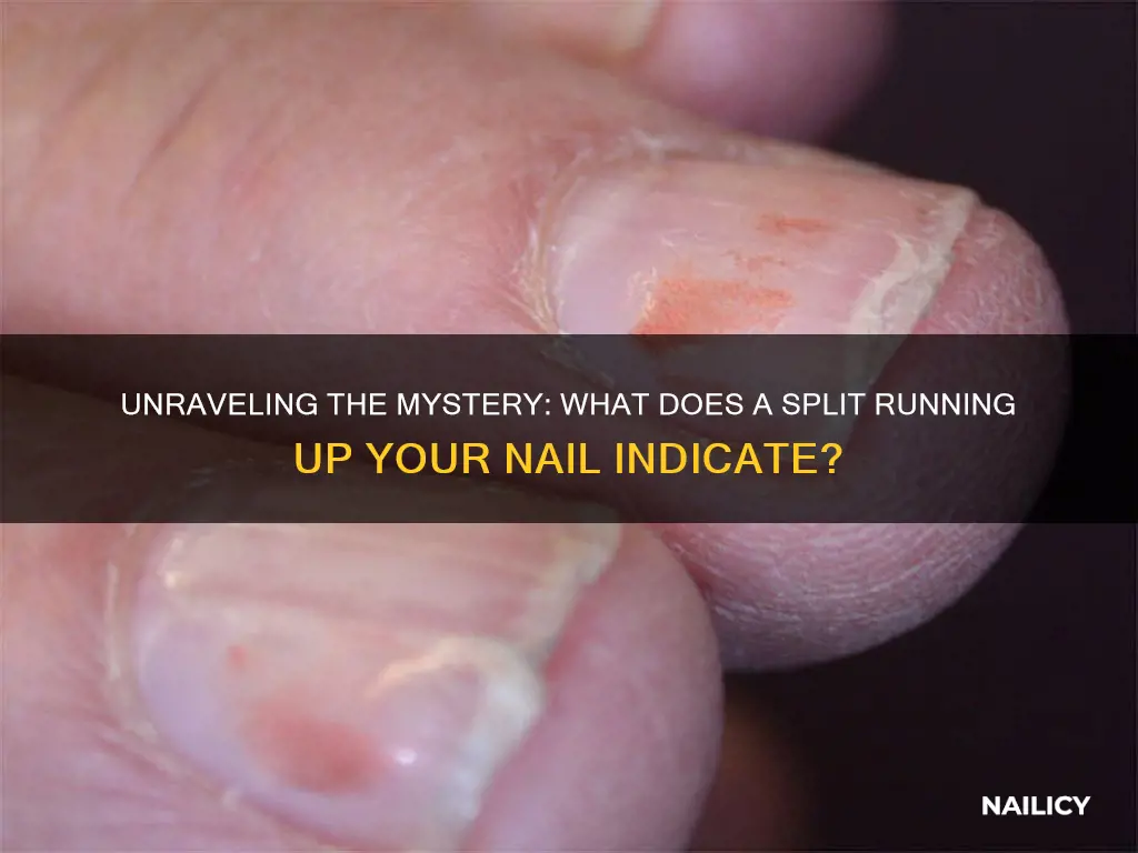 what does a split running up your nail mean