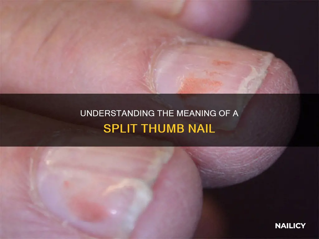 what does a split thumb nail mean