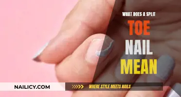 Toe Nail Split: What Does It Mean?