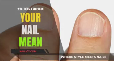 Unraveling the Mystery: What Your Nail Streak Reveals