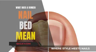 Sunken Nail Beds: What They Mean for Your Health