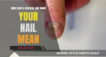 Vertical Lines on Nails: What Do They Indicate?