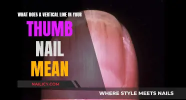 Vertical Thumb Nail Lines: What's the Meaning?