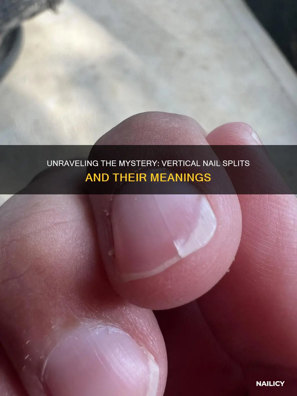 what does a vertical split in your nail mean