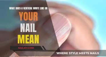 Unraveling the Mystery: Vertical White Line on Your Nail