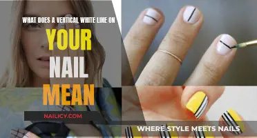 White Lines on Nails: What's the Underlying Health Issue?