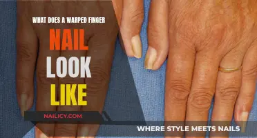 Warped Nail: Understanding the Signs and Causes