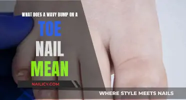 Toe Nail Woes: What Do Wavy Bumps Mean?