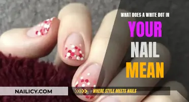 White Dot on Your Nail: What Does It Mean?