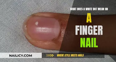 Unraveling the Mystery: White Dot on Your Nail