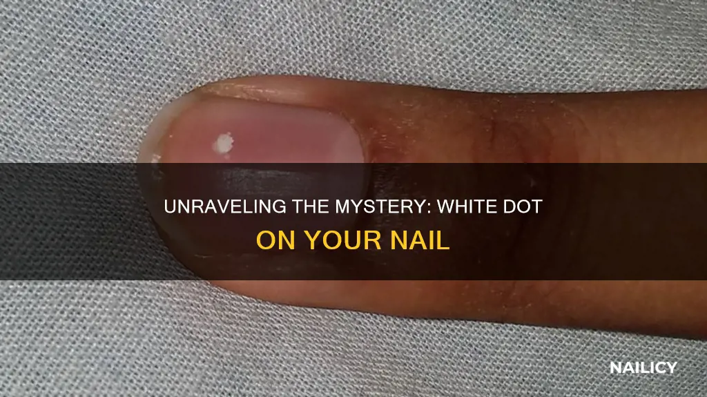 what does a white dot mean on a finger nail