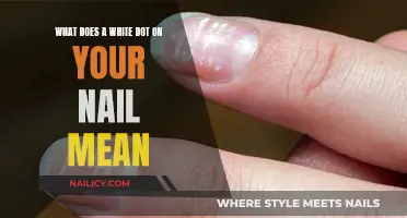 Unraveling the Mystery: White Dot on Your Nail