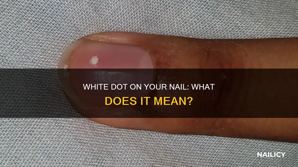 what does a white dot on your nail mean