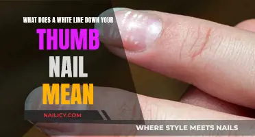 Unraveling the Mystery: White Line on Thumb Nail