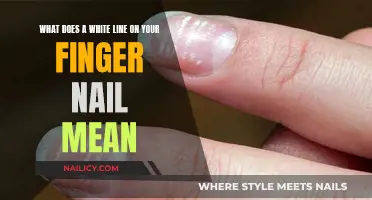 Unraveling the Mystery: What Causes a White Line on Your Nail?