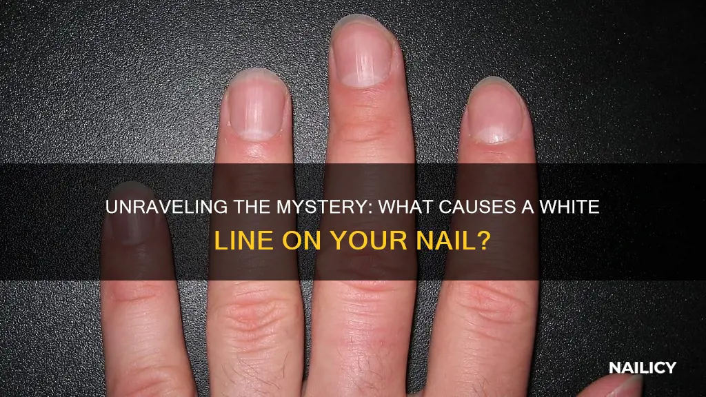 what does a white line on your finger nail mean