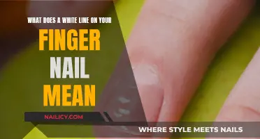 White Lines on Fingernails: What Do They Mean?