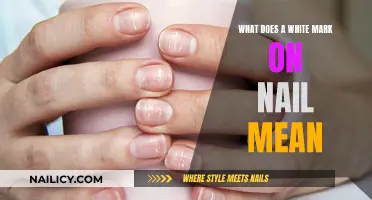 Unraveling the Mystery: White Marks on Nails