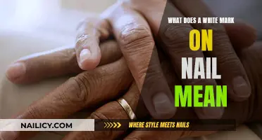 White Marks on Nails: What Do They Mean?