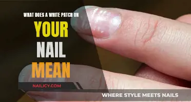 Uncover the Mystery: White Patches on Your Nails