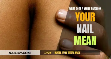 White Nails: What Do Those Patches Mean?