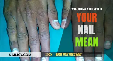 White Spots on Nails: What's the Meaning?