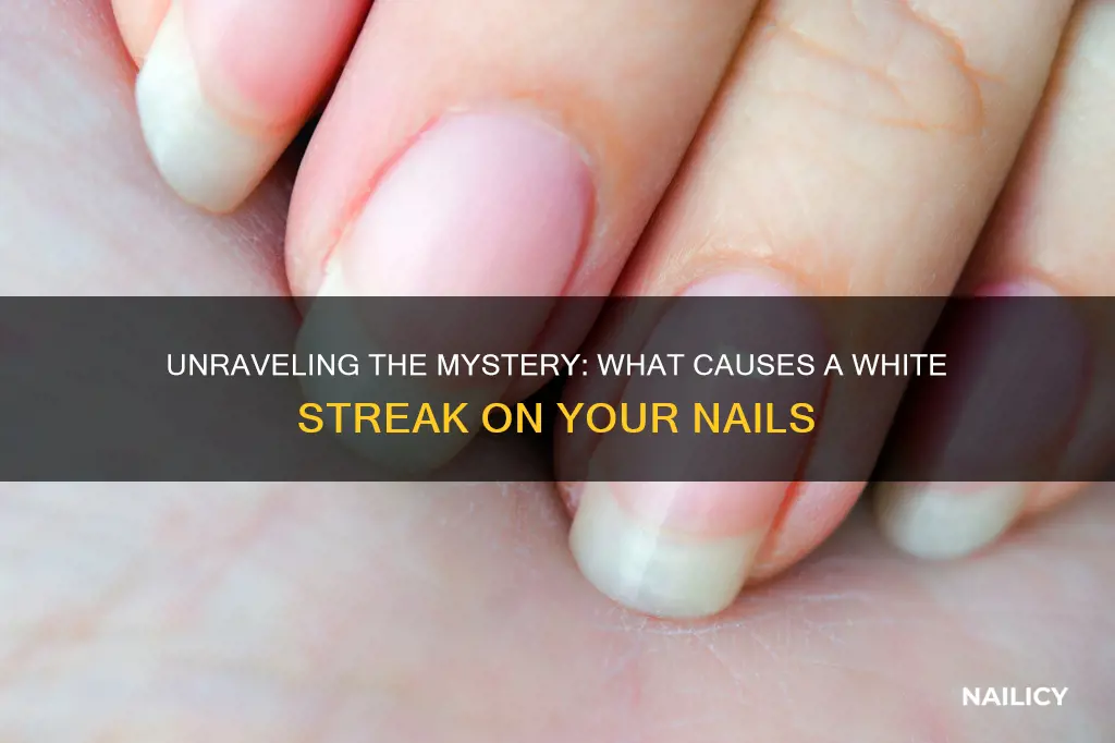 what does a white streak on your nail mean