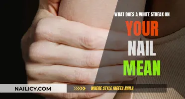 White Streaks on Nails: What Do They Mean?