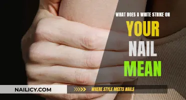 White Strikes on Nails: What's the Meaning?