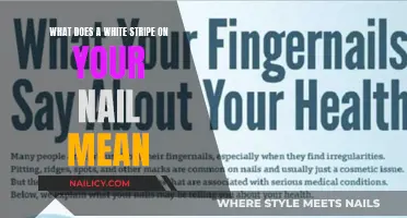 Unraveling the Mystery: What Your White Stripe on Nails Reveals