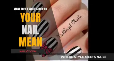 White Stripes on Nails: What's the Underlying Health Meaning?