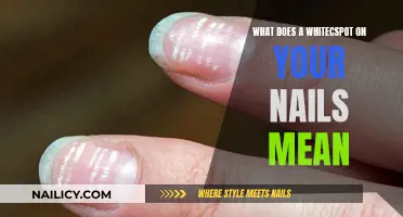 Uncover the Mystery: What Your Nail White Spots Reveal