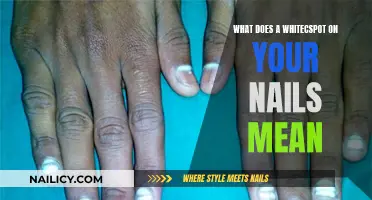 The Mystery of White Spots on Nails Revealed