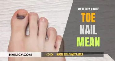 Wide Toenail Woes: What Does It Mean?
