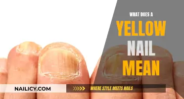 Unraveling the Mystery: What Does a Yellow Nail Indicate?