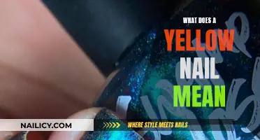 Yellow Nails: What Do They Mean?
