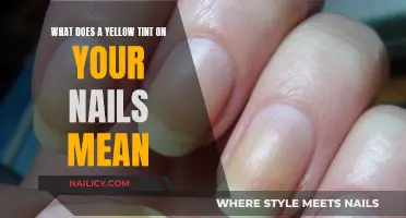 Uncover the Mystery: Why Your Nails Turn Yellow