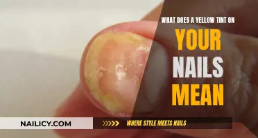 Yellow Nails: What Does This Tinge Mean?