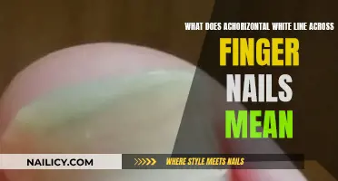 White Lines on Nails: What Do They Mean?