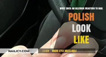 Recognizing Nail Polish Allergy Symptoms: Signs and Skin Reactions Explained