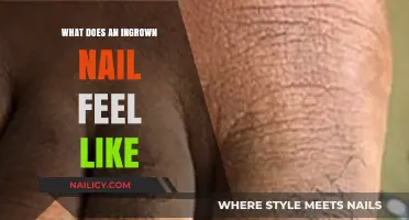 Understanding Ingrown Nail Pain: Symptoms, Sensations, and Early Warning Signs