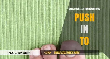 Understanding Ingrown Nails: What Tissue Does the Nail Push Into?