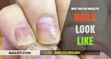Unhealthy Nails: Signs, Symptoms, and What to Look For