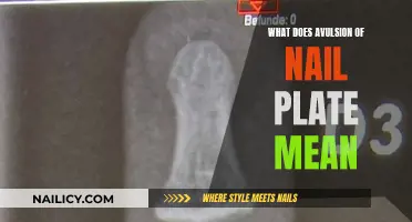 Understanding Avulsion: Nail Plate Trauma and Treatment