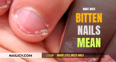 Chewed Nails: What Does This Body Language Signify?