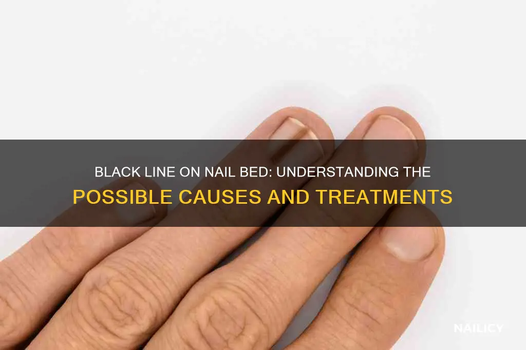 what does black line in nail bed mean