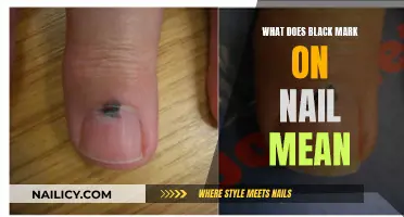 Black Marks on Nails: What Do They Mean?